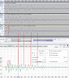 125Hz in room + bandpass.png